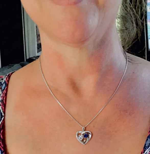 Customer review photo
